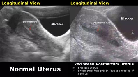 usg for obstetrics anomalies scan